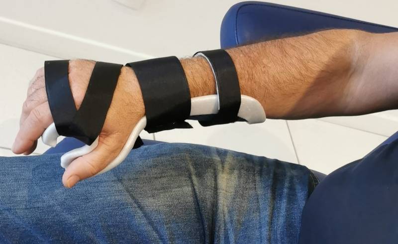 Fabrication orthèse sur mesure canal carpien Venelles