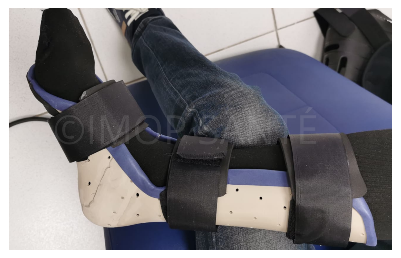 Orthèse sur mesure arrachement osseux malléole externe proche d’Aix en Provence