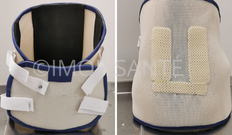 Réalisation d’un corset thermoformé sur-mesure pour fracture L4 